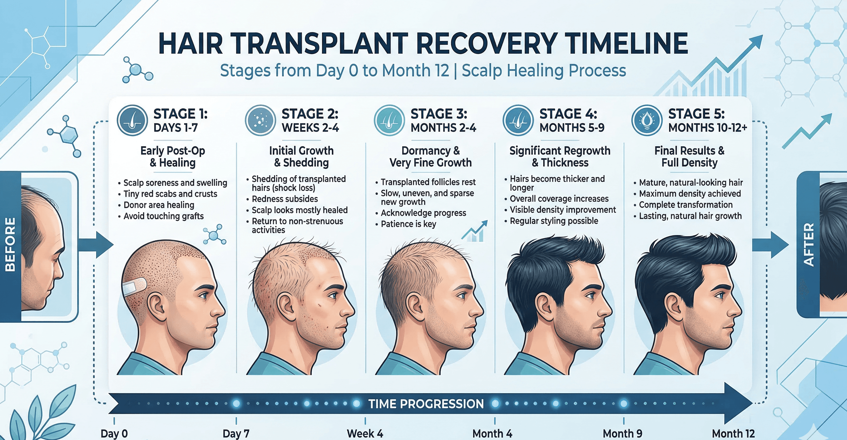 Hair Transplant Recovery Timeline: Day-by-Day Healing Process, What to Expect & Mistakes to Avoid (2026 Guide)